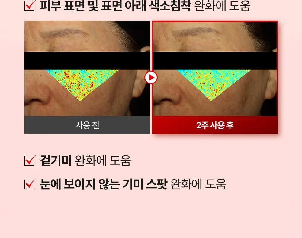 [기미잡티] 메디필 멜라논엑스 앰플 RX 30ml 상세페이지 32